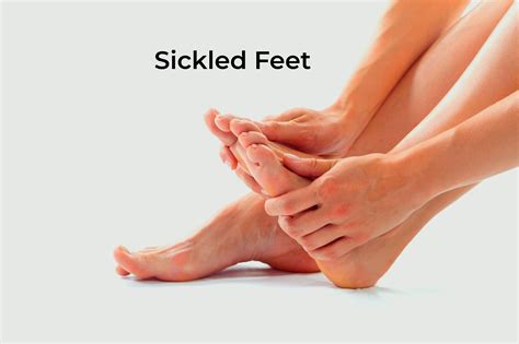 what's a sickled foot|injury from sickled foot.